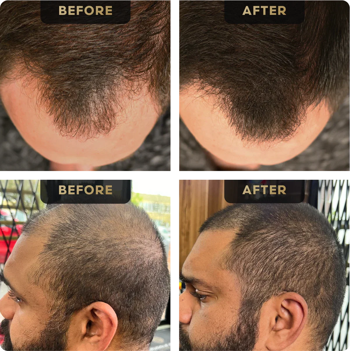 Hair Concealer - Image 2